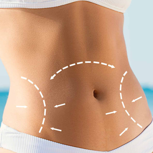 Liposuction